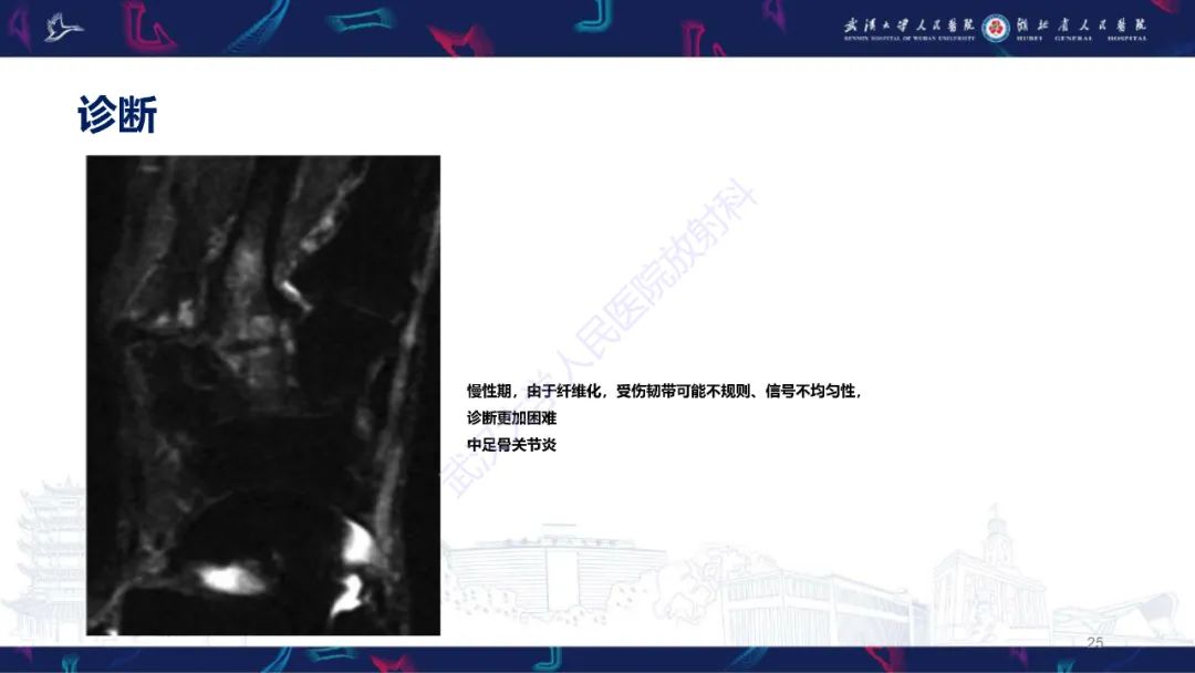 影像PPT - 【PPT】Lisfranc关节损伤影像诊断-25