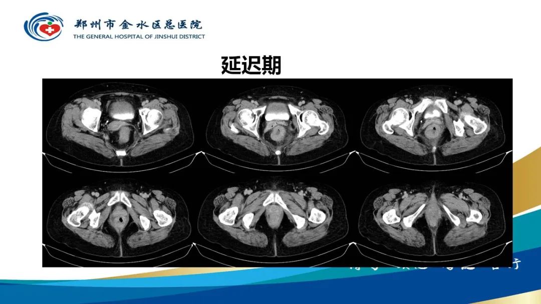 影像PPT - 【病例】直肠癌1例CT及MR影像诊断与鉴别-6