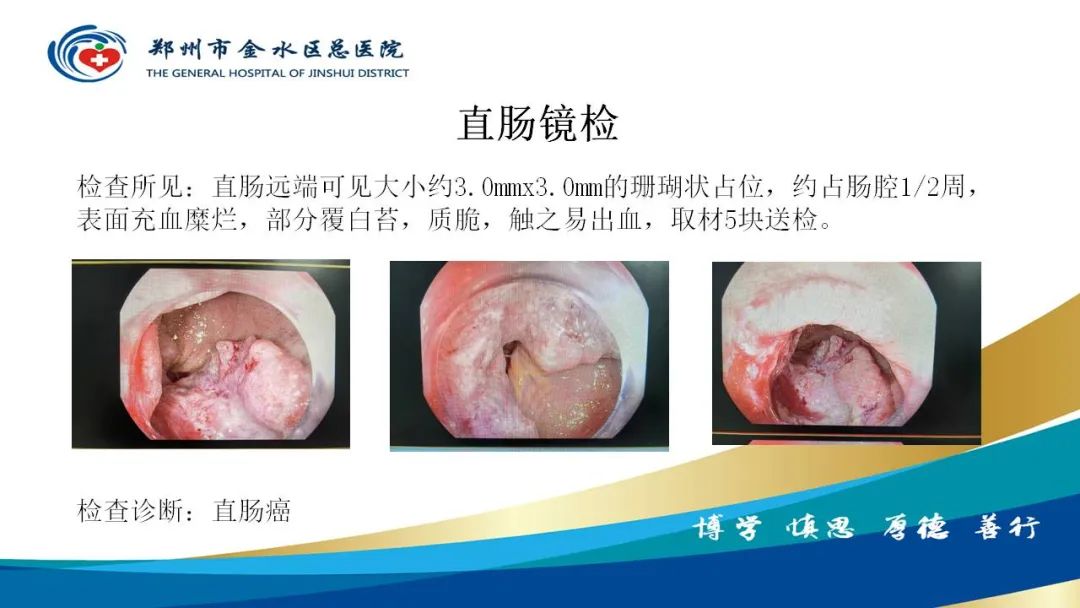 影像PPT - 【病例】直肠癌1例CT及MR影像诊断与鉴别-12