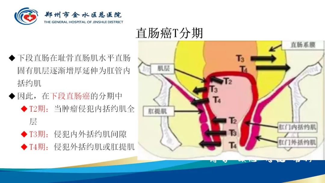 影像PPT - 【病例】直肠癌1例CT及MR影像诊断与鉴别-21