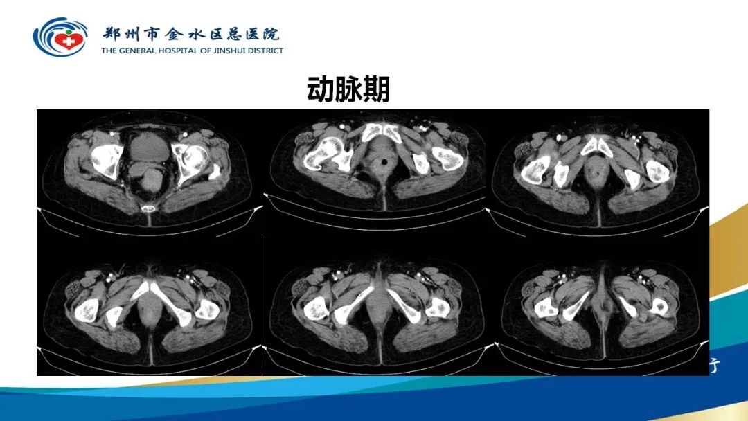 影像PPT - 【病例】直肠癌1例CT及MR影像诊断与鉴别-4
