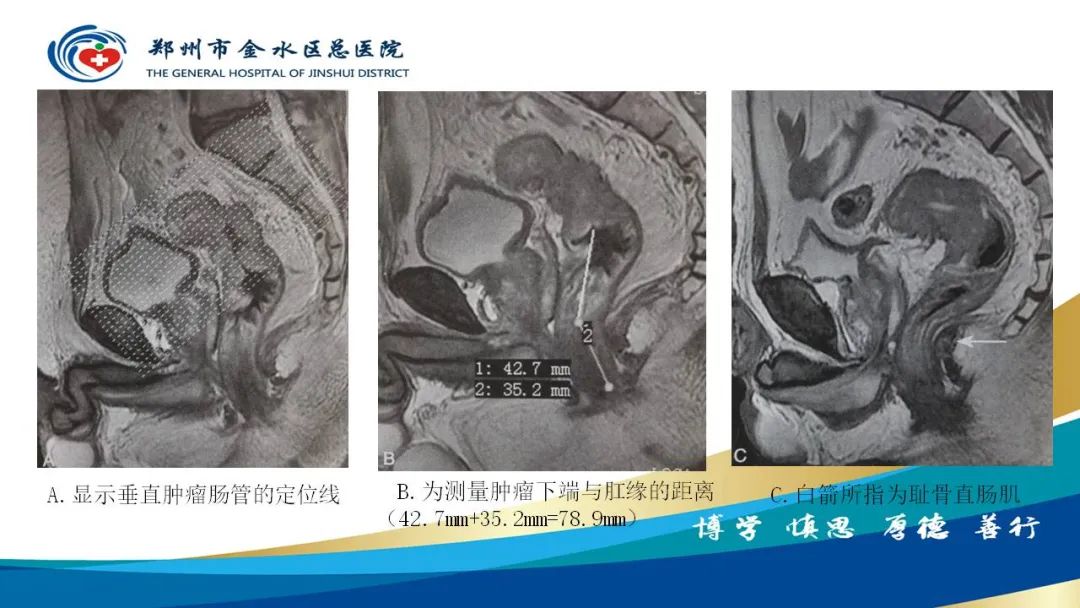 影像PPT - 【病例】直肠癌1例CT及MR影像诊断与鉴别-27