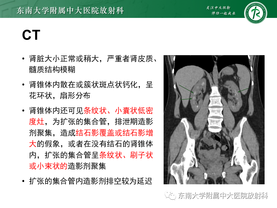 影像PPT - 【PPT】肾脏钙化性病变-9