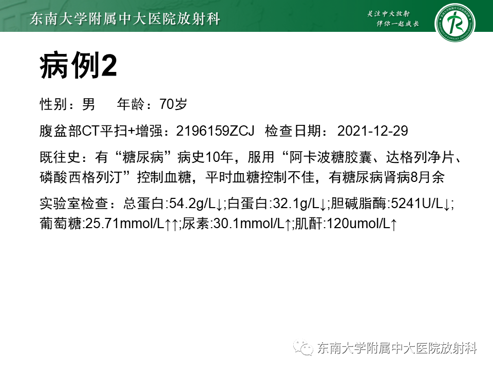 影像PPT - 【PPT】肾脏钙化性病变-13