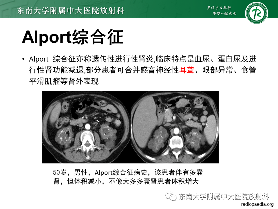 影像PPT - 【PPT】肾脏钙化性病变-22