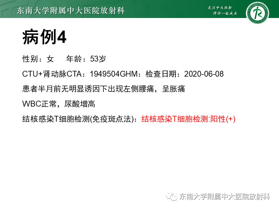 影像PPT - 【PPT】肾脏钙化性病变-27