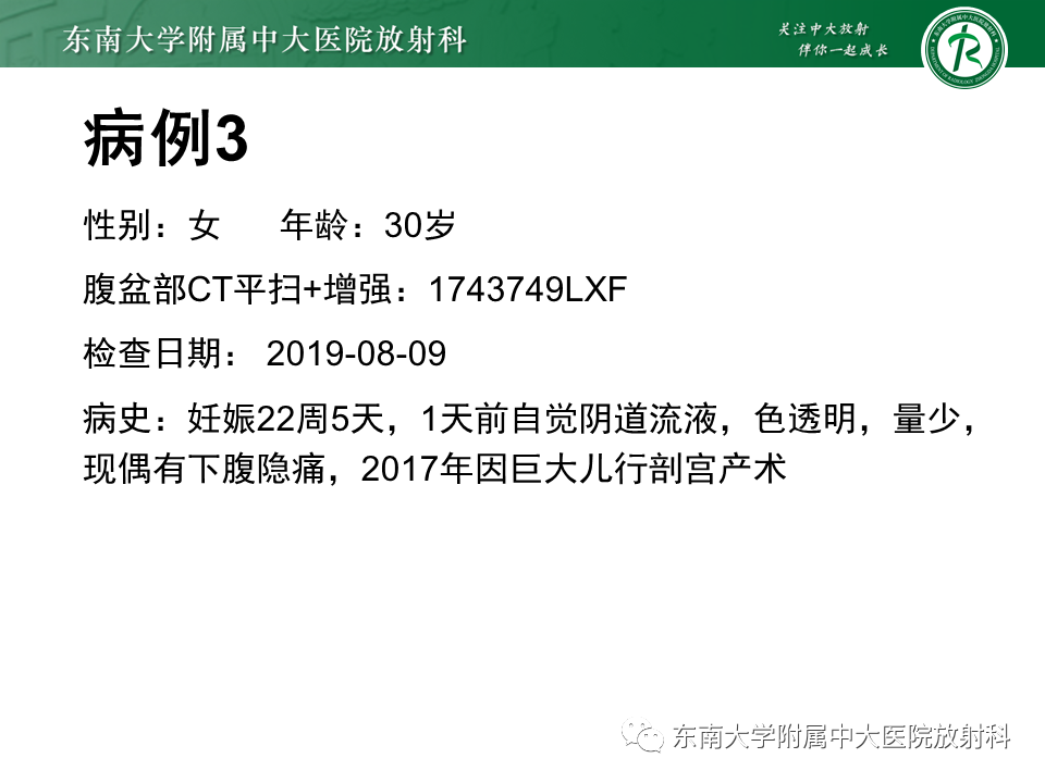 影像PPT - 【PPT】肾脏钙化性病变-20