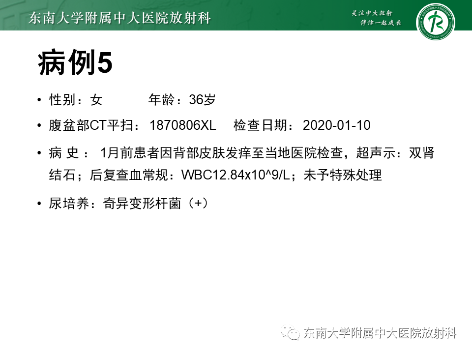 影像PPT - 【PPT】肾脏钙化性病变-31