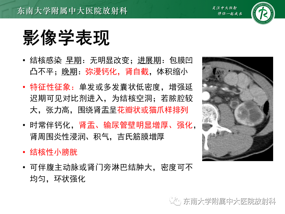 影像PPT - 【PPT】肾脏钙化性病变-26