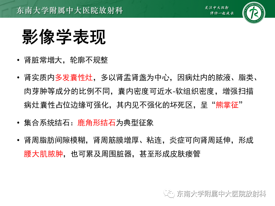 影像PPT - 【PPT】肾脏钙化性病变-30