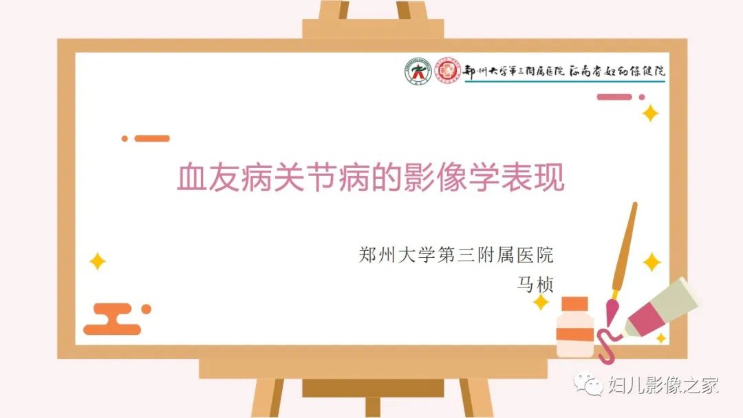 影像PPT - 【PPT】血友病关节病的影像学表现-1