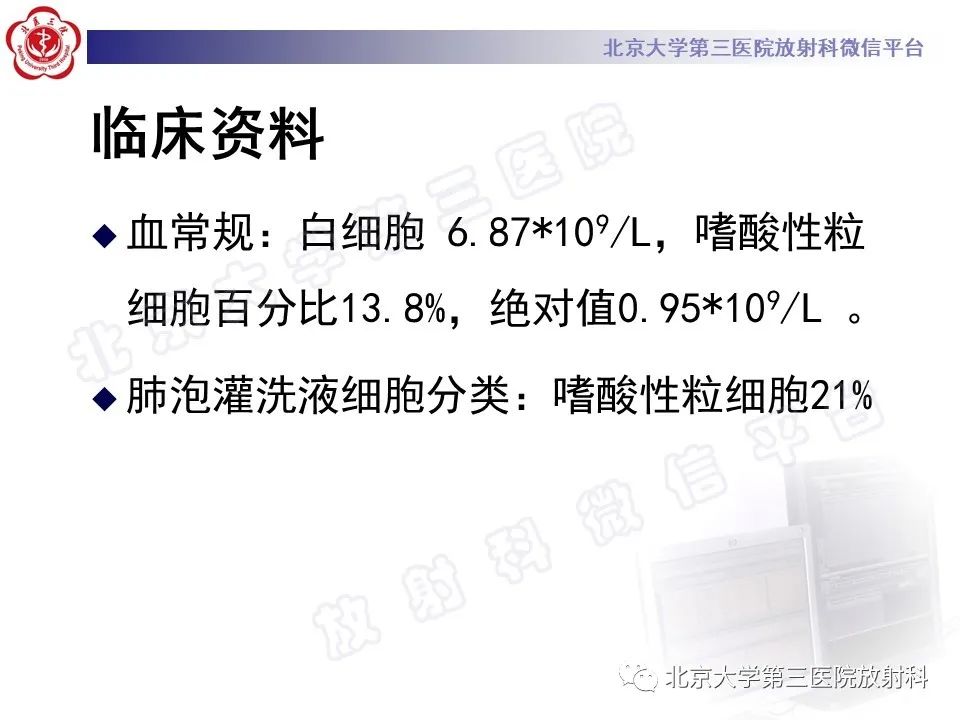 影像PPT - 【PPT】嗜酸性粒细胞性肺病-8
