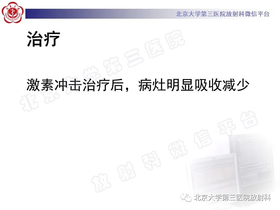 影像PPT - 【PPT】嗜酸性粒细胞性肺病-10