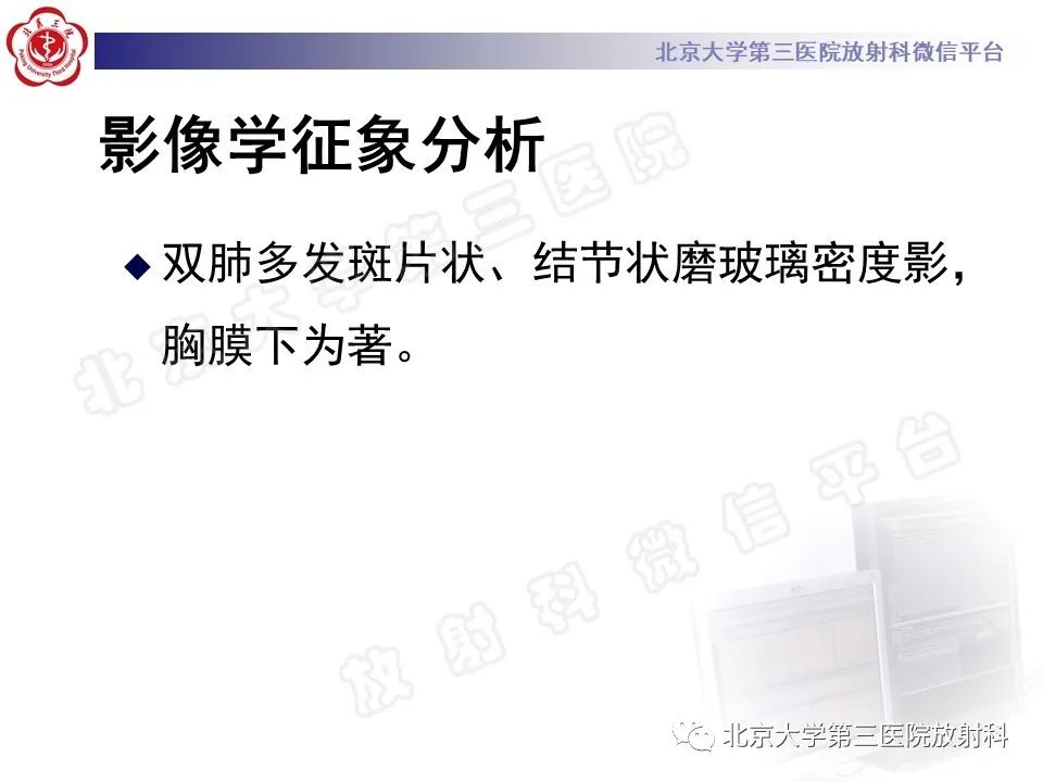 影像PPT - 【PPT】嗜酸性粒细胞性肺病-6