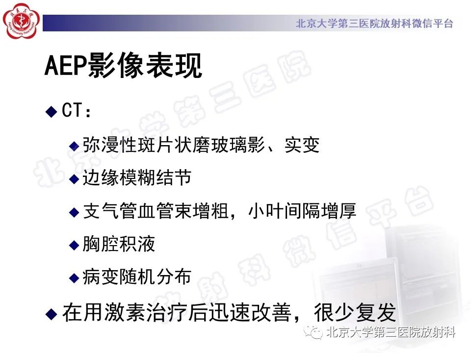影像PPT - 【PPT】嗜酸性粒细胞性肺病-25