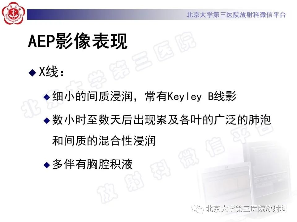 影像PPT - 【PPT】嗜酸性粒细胞性肺病-24