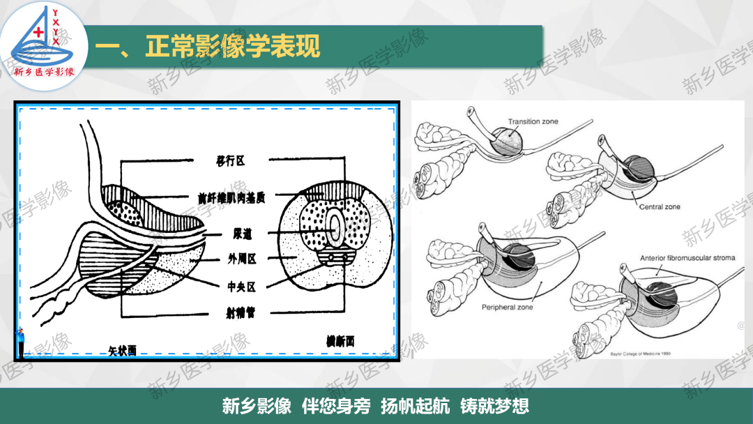 影像PPT - 【PPT】男性生殖系统解剖及常见病变影像表现-3