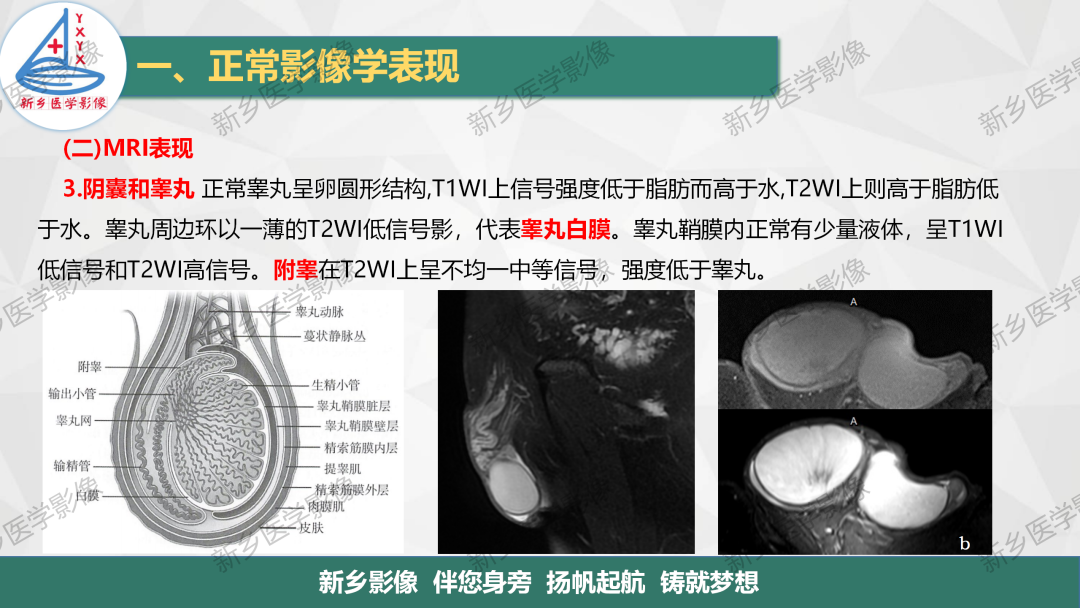 影像PPT - 【PPT】男性生殖系统解剖及常见病变影像表现-9