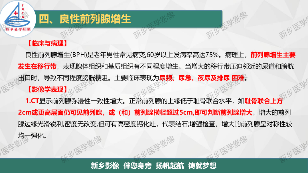 影像PPT - 【PPT】男性生殖系统解剖及常见病变影像表现-15