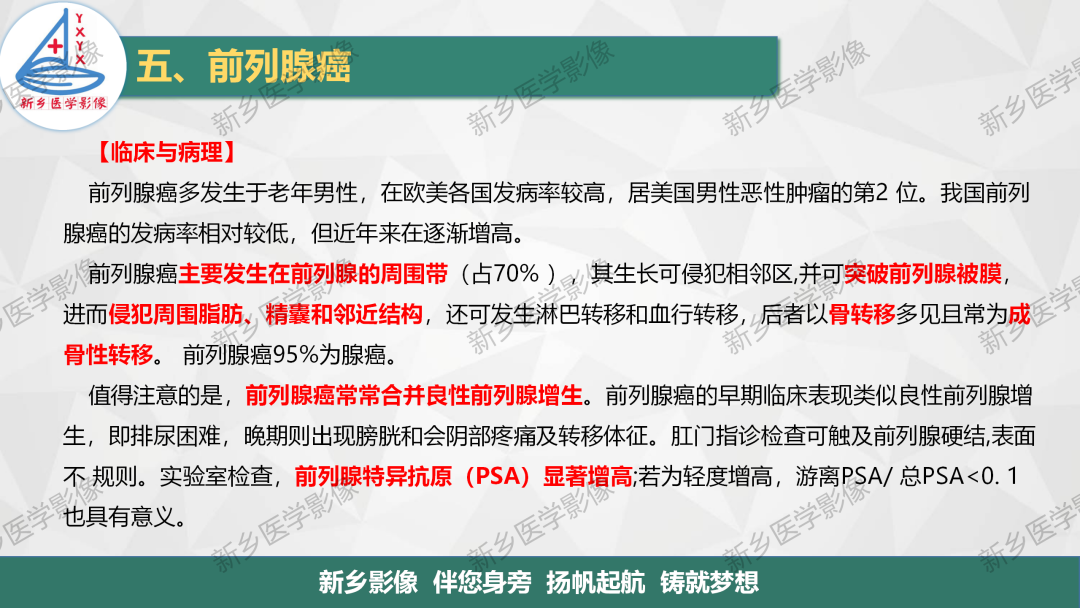 影像PPT - 【PPT】男性生殖系统解剖及常见病变影像表现-19