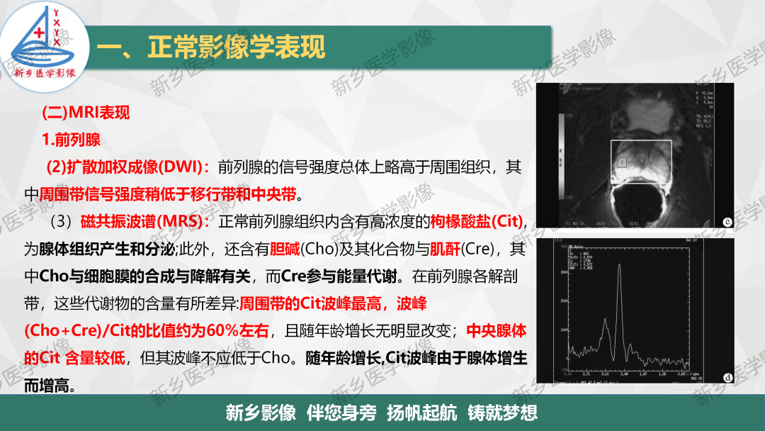 影像PPT - 【PPT】男性生殖系统解剖及常见病变影像表现-7