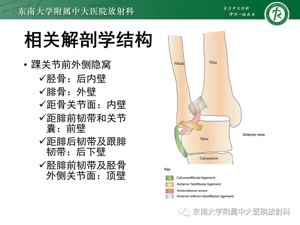 影像PPT - 【PPT】踝关节撞击综合征-11