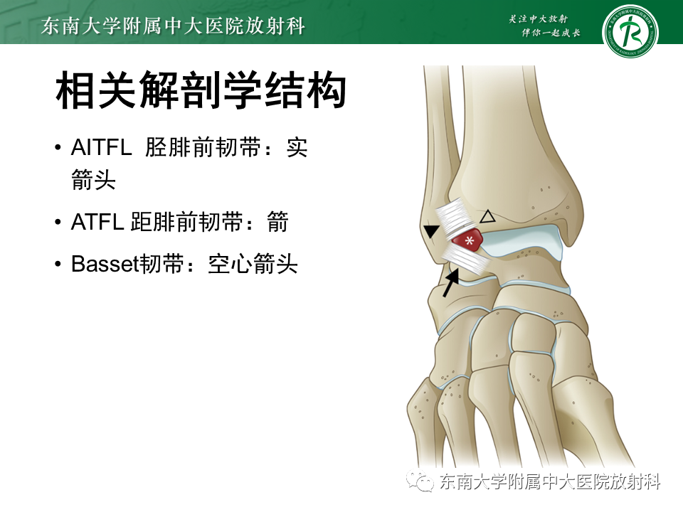 影像PPT - 【PPT】踝关节撞击综合征-13