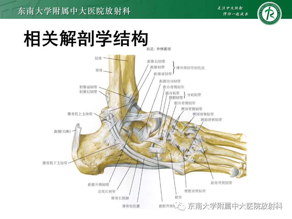 影像PPT - 【PPT】踝关节撞击综合征-12