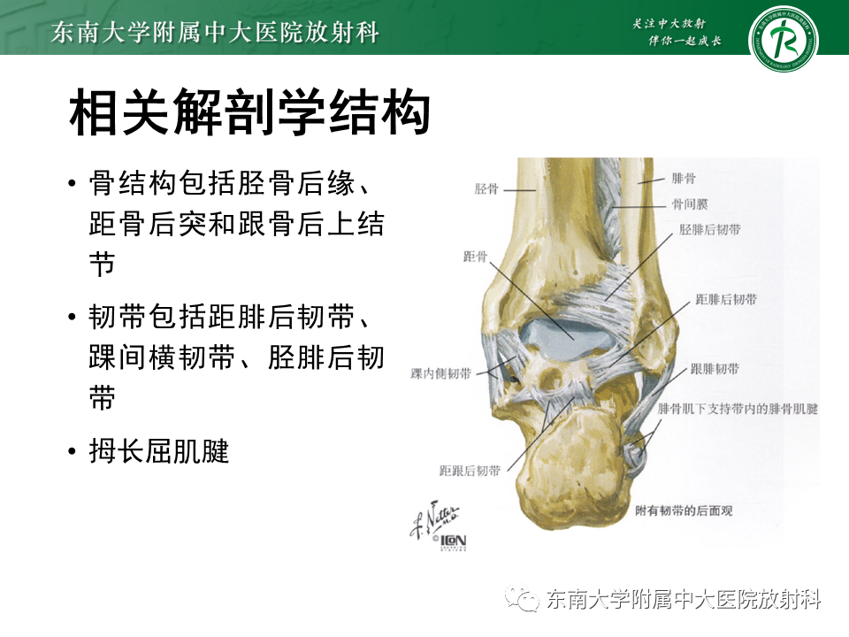 影像PPT - 【PPT】踝关节撞击综合征-25