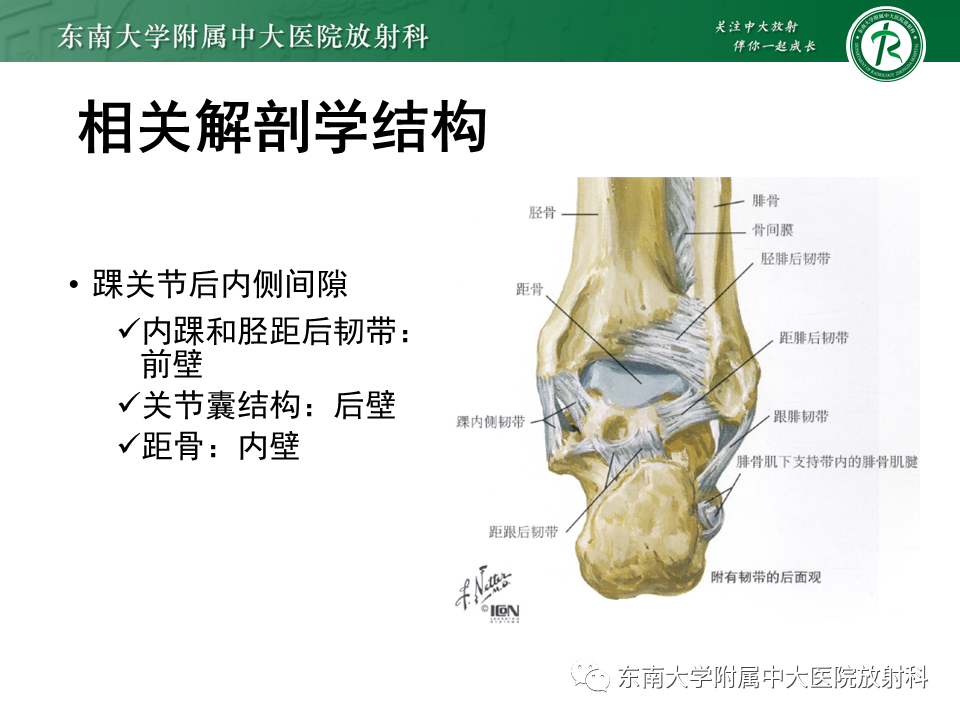 影像PPT - 【PPT】踝关节撞击综合征-31