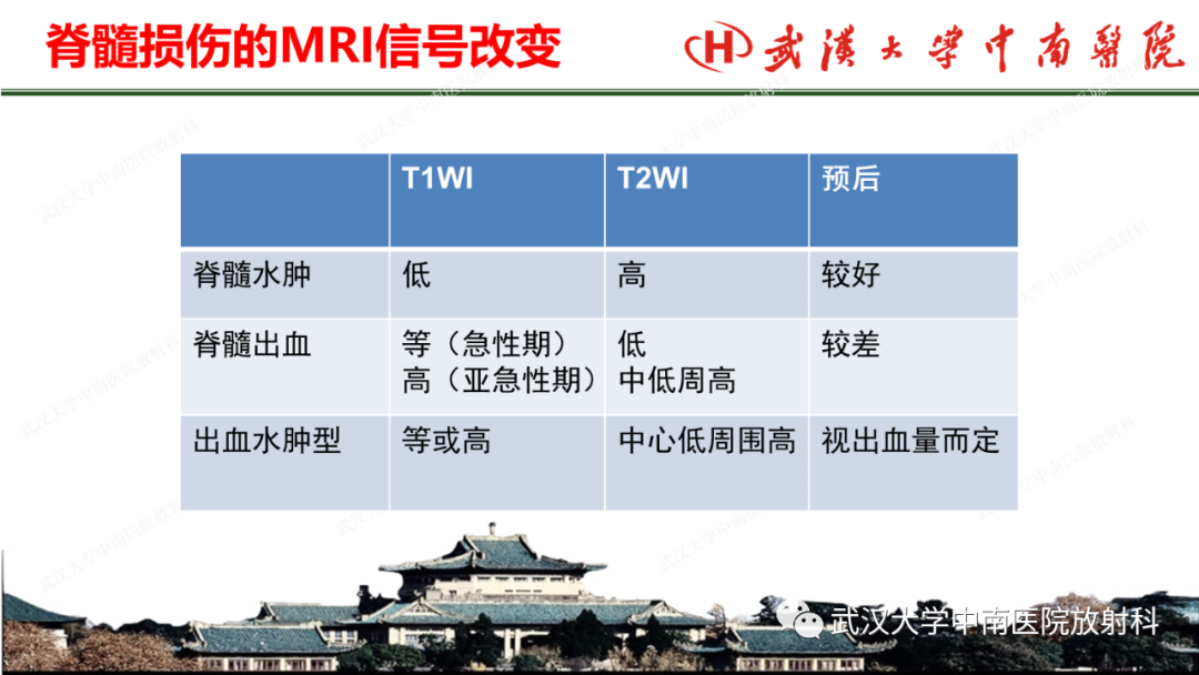 影像PPT - 【PPT】脊柱外伤的影像分析-10