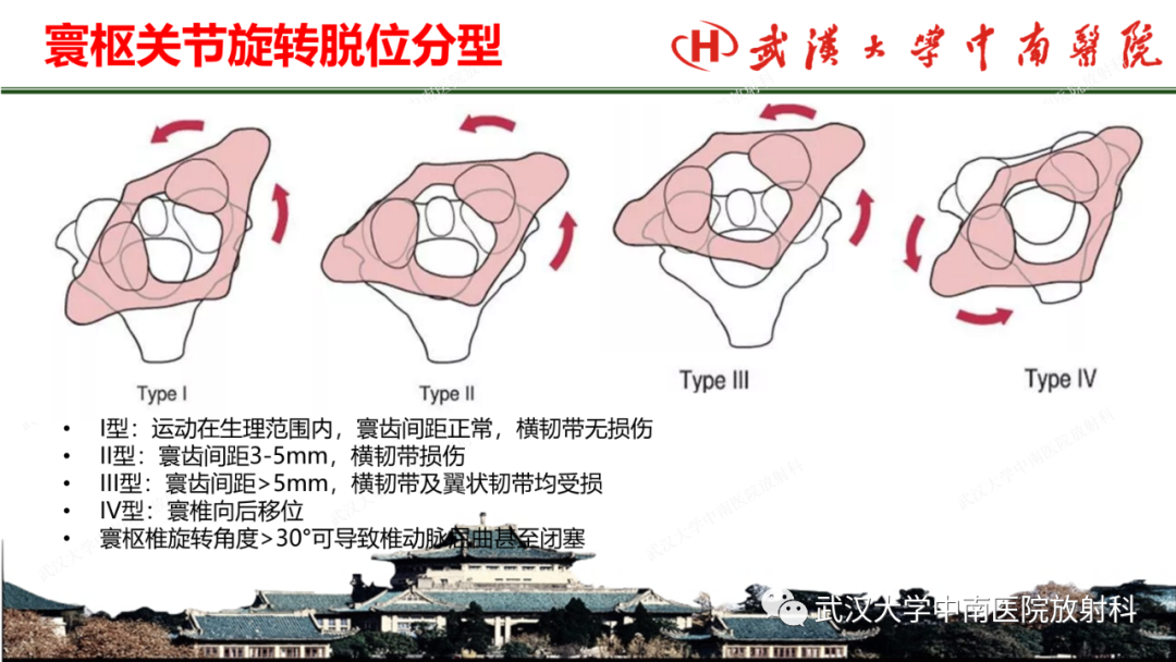 影像PPT - 【PPT】脊柱外伤的影像分析-39
