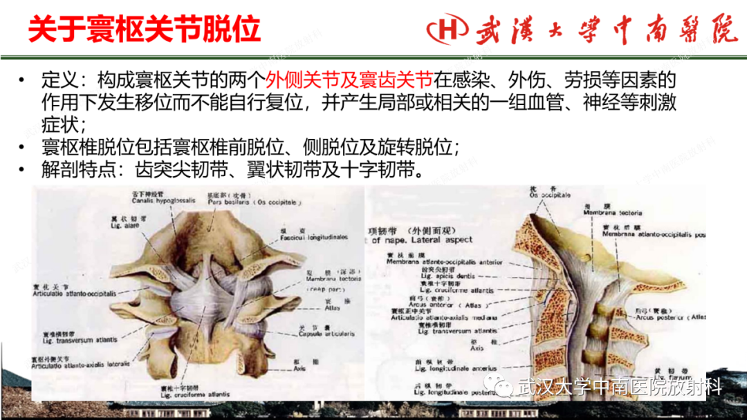 影像PPT - 【PPT】脊柱外伤的影像分析-31
