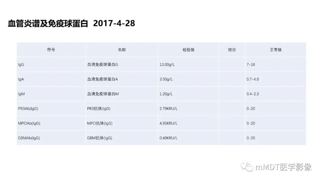 影像PPT - 【PPT】神经白塞病病例分析及综述-24 影像PPT - 【PPT】神经白塞病病例分析及综述-24