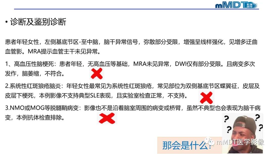 影像PPT - 【PPT】神经白塞病病例分析及综述-31 影像PPT - 【PPT】神经白塞病病例分析及综述-31