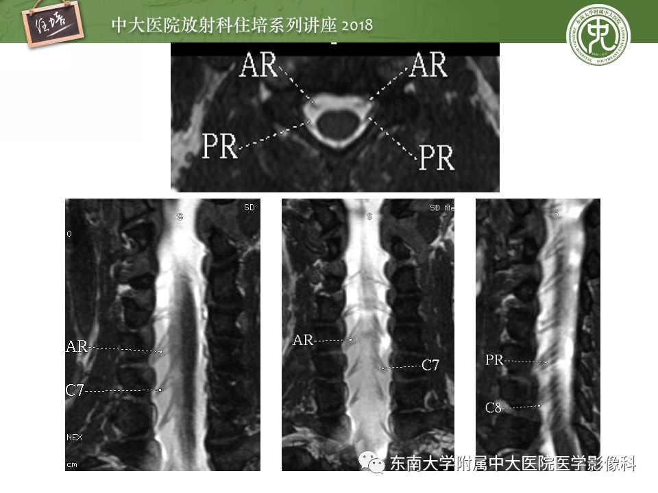 影像PPT - 【PPT】外周神经影像解剖及相关疾病简介-7