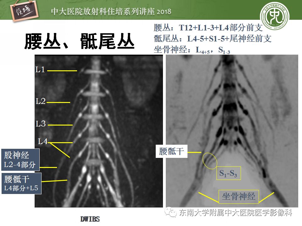 影像PPT - 【PPT】外周神经影像解剖及相关疾病简介-13