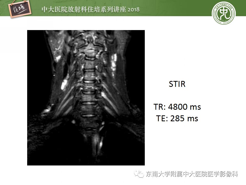 影像PPT - 【PPT】外周神经影像解剖及相关疾病简介-16