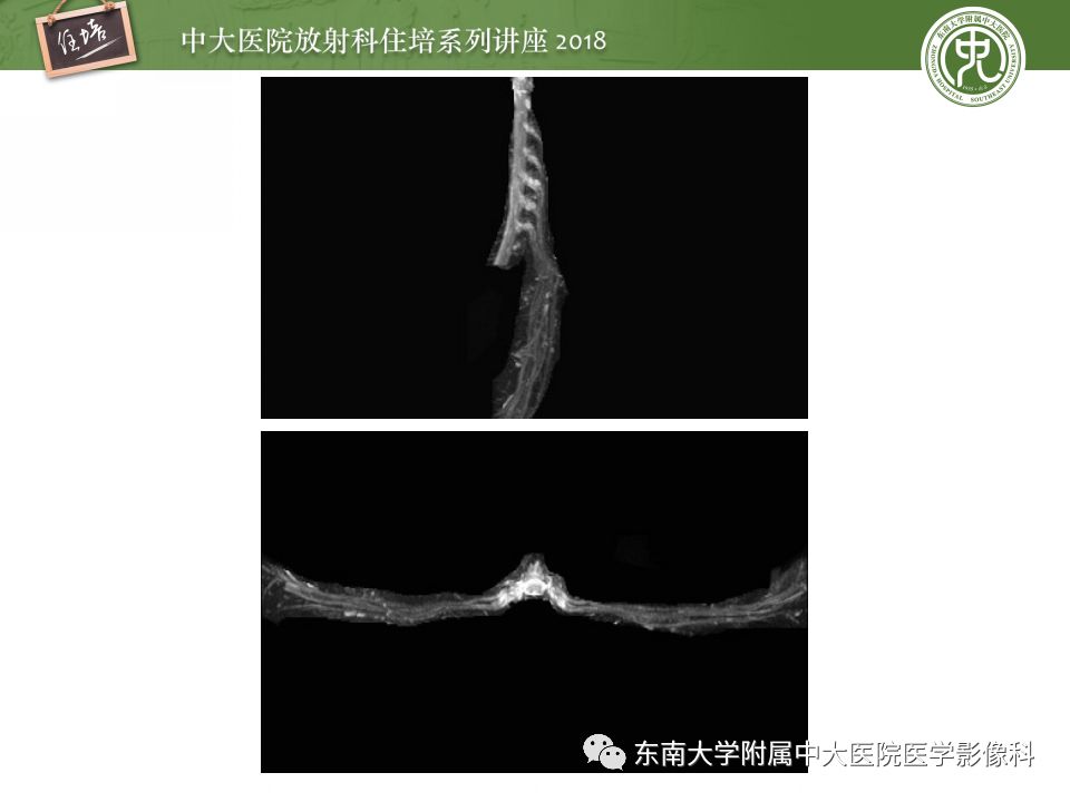 影像PPT - 【PPT】外周神经影像解剖及相关疾病简介-10