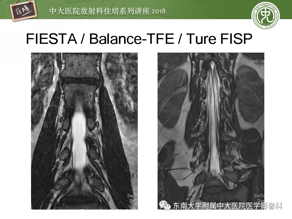 影像PPT - 【PPT】外周神经影像解剖及相关疾病简介-18