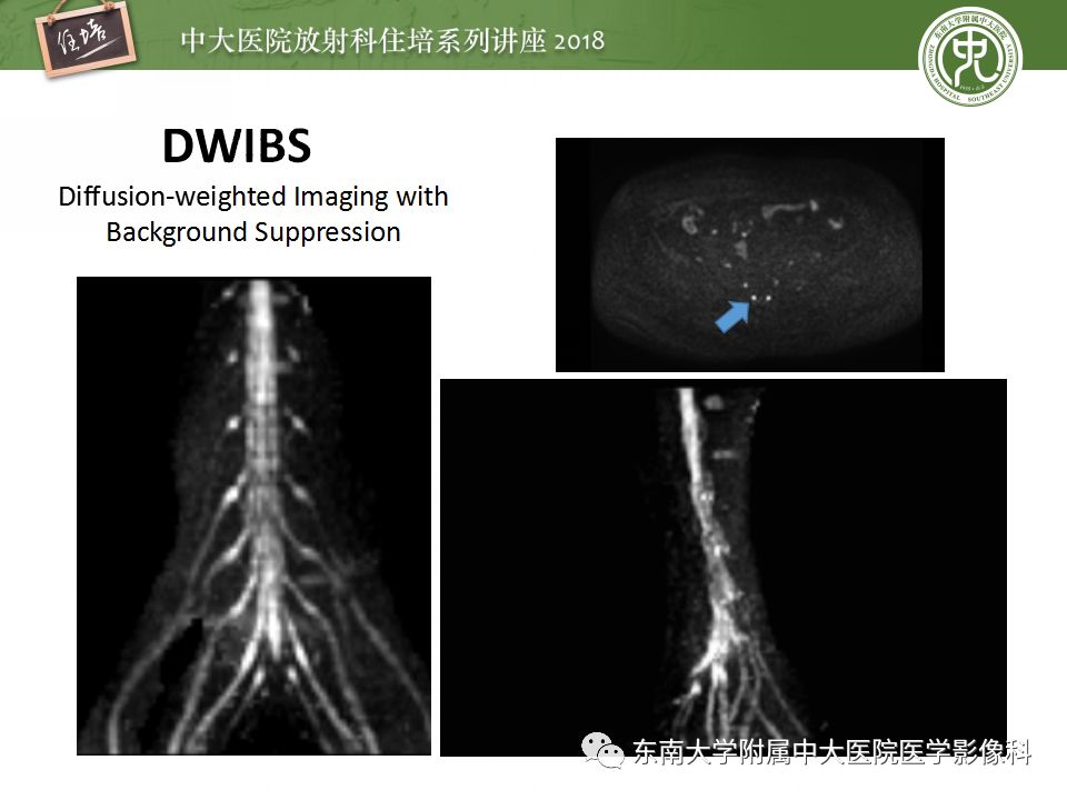 影像PPT - 【PPT】外周神经影像解剖及相关疾病简介-20