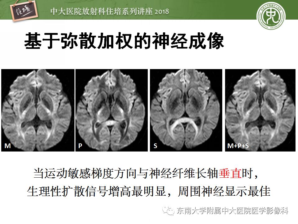 影像PPT - 【PPT】外周神经影像解剖及相关疾病简介-19