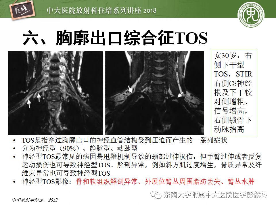 影像PPT - 【PPT】外周神经影像解剖及相关疾病简介-46