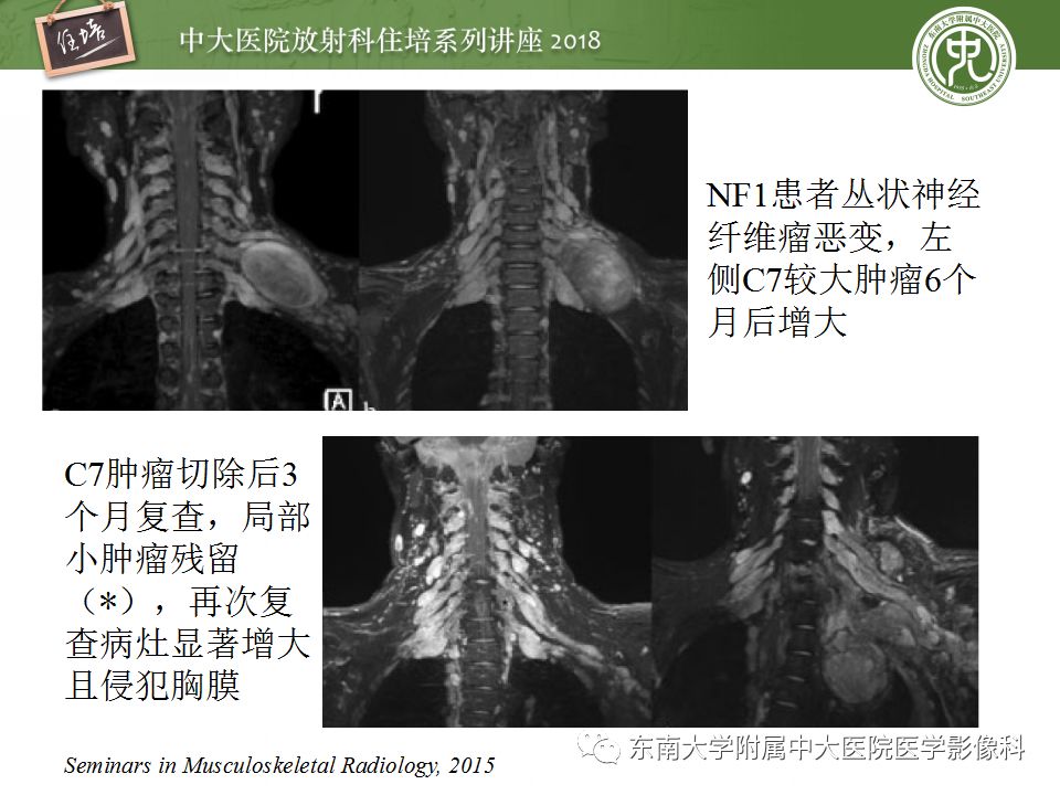 影像PPT - 【PPT】外周神经影像解剖及相关疾病简介-1