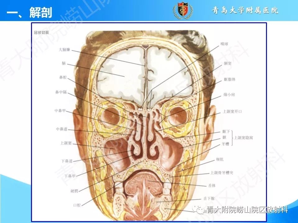 影像PPT - 【PPT】鼻和鼻窦-7