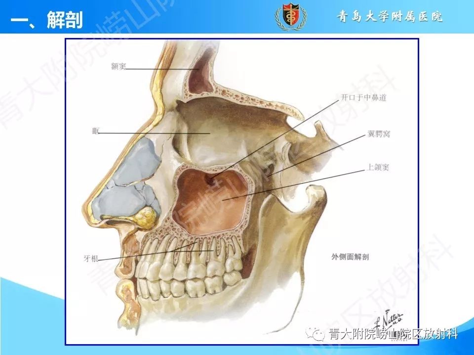 影像PPT - 【PPT】鼻和鼻窦-5