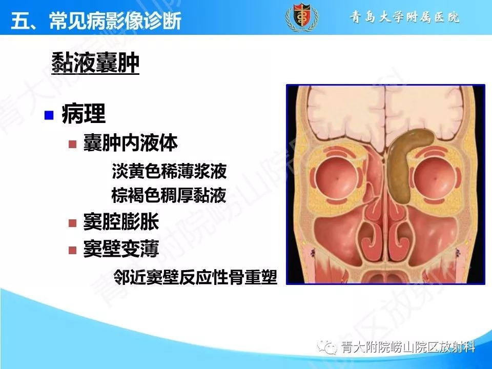 影像PPT - 【PPT】鼻和鼻窦-32