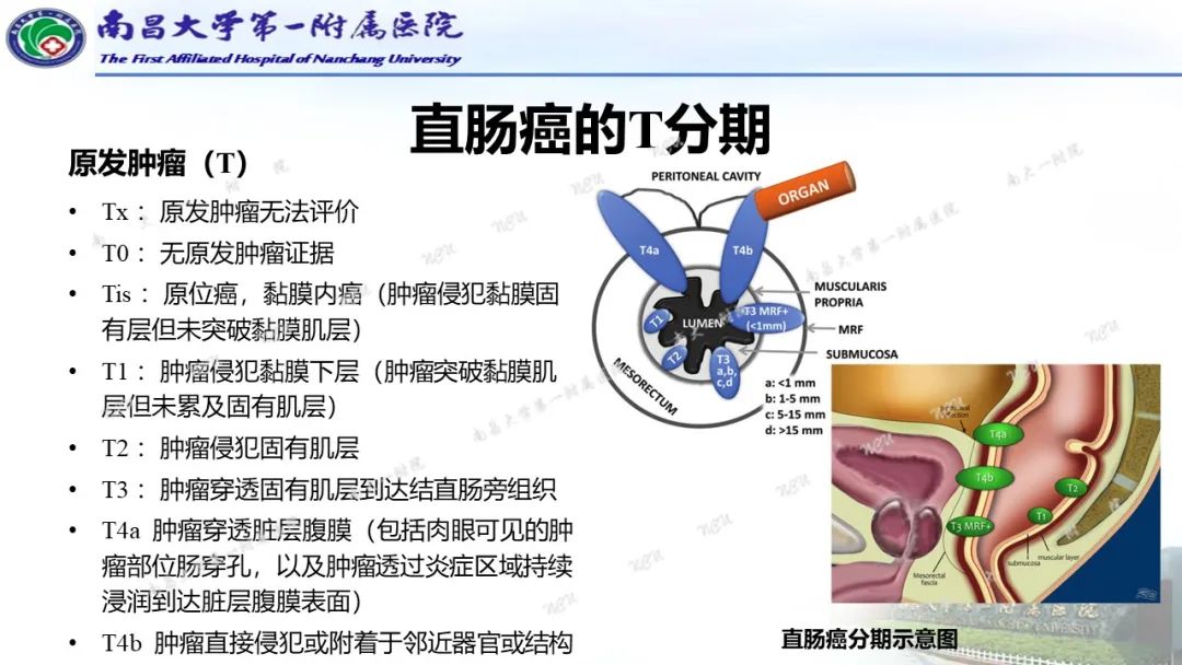 影像PPT - 【PPT】直肠癌MRI分期-16