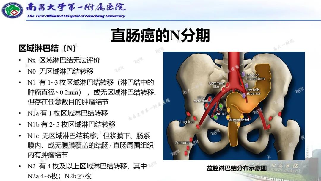 影像PPT - 【PPT】直肠癌MRI分期-23