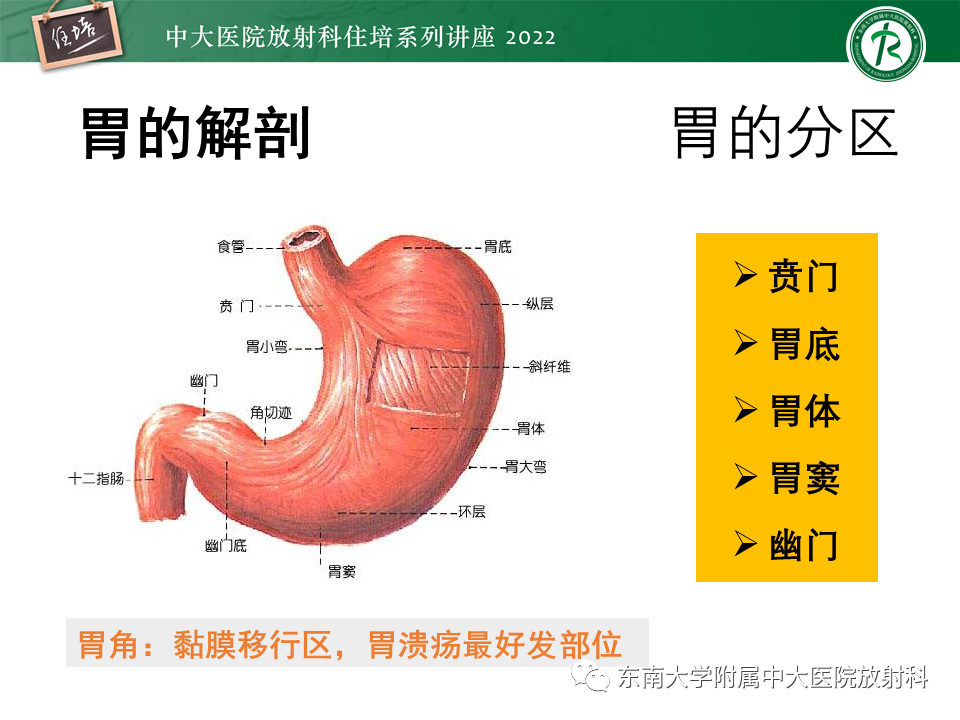 影像PPT - 【PPT】常见胃部急症的影像学征象分析-3